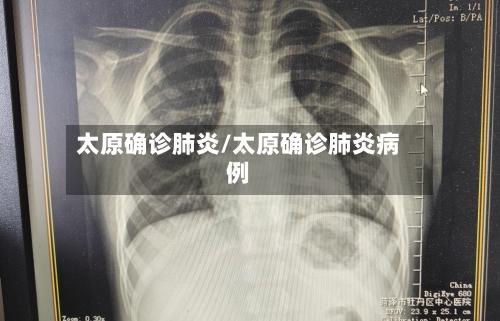 太原确诊肺炎/太原确诊肺炎病例