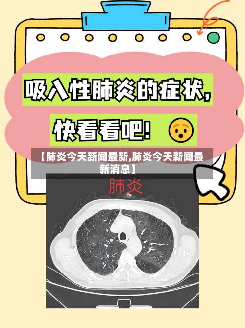 【肺炎今天新闻最新,肺炎今天新闻最新消息】-第3张图片