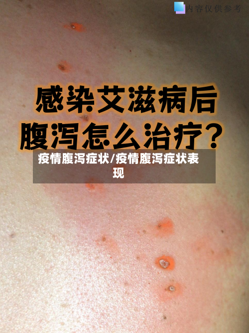 疫情腹泻症状/疫情腹泻症状表现